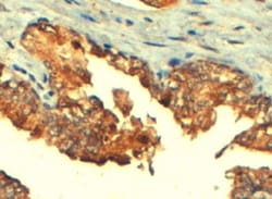 MRP4/ABCC4 Antibody, Novus Biologicals 0.1mg; Unlabeled:Antibodies, Polyclonal